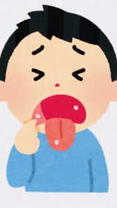 口内炎
