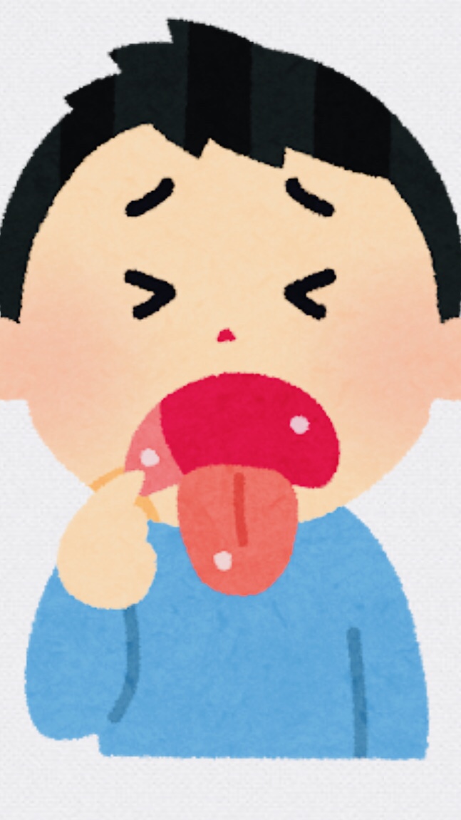 口内炎